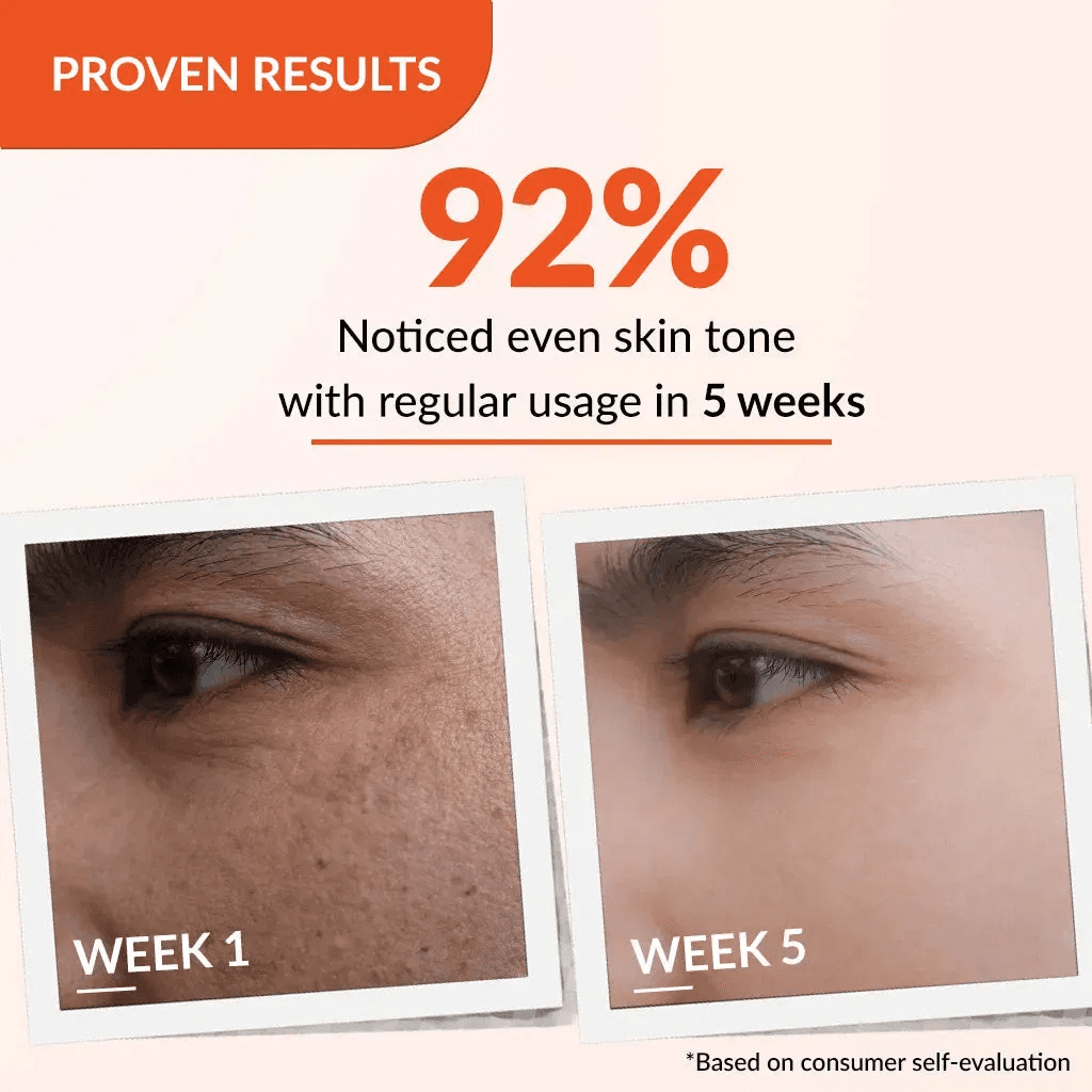 Tạm biệt thâm nám, tàn nhang với Kem dưỡng Fixderma Skarfix-TX Cream 15g! 5 image 28