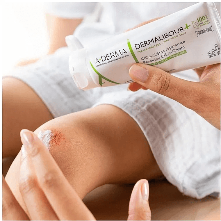 DA ĐANG KÍCH ỨNG, ĐỎ RÁT, VIÊM NHIỄM? HÃY ĐỂ A-DERMA CỨU CÁNH! 4 image 68